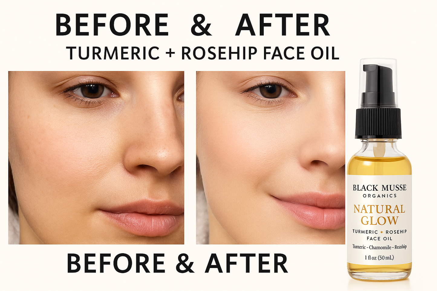 Turmeric & Rosehip Face Oil -Natural Glow Moisturizer